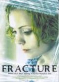 Fracture pictures.