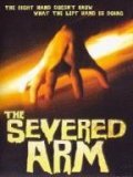 The Severed Arm pictures.