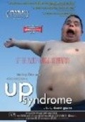 Up Syndrome pictures.